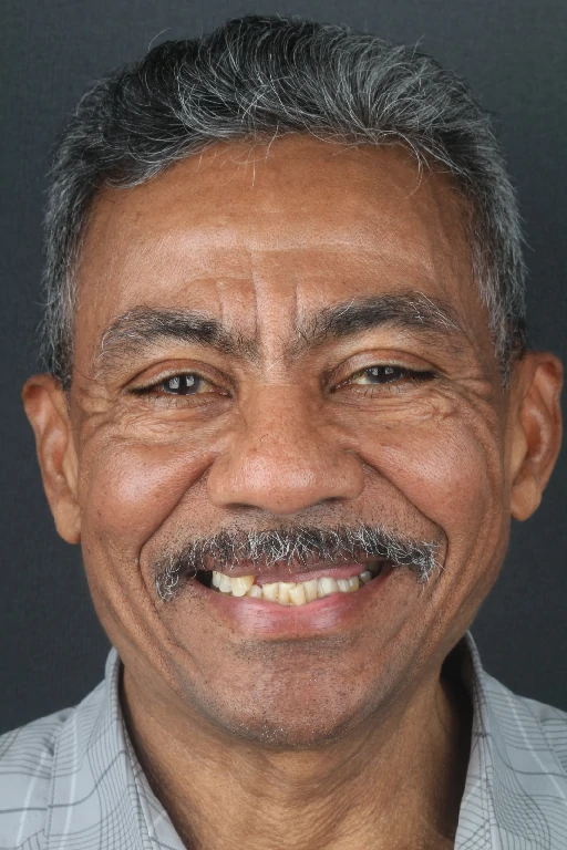 Caso 1 - Odontología Digital