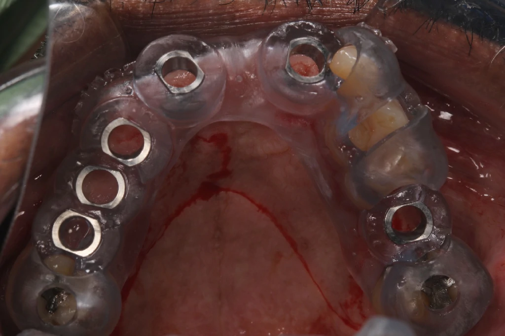 Caso 1 - Odontología Digital