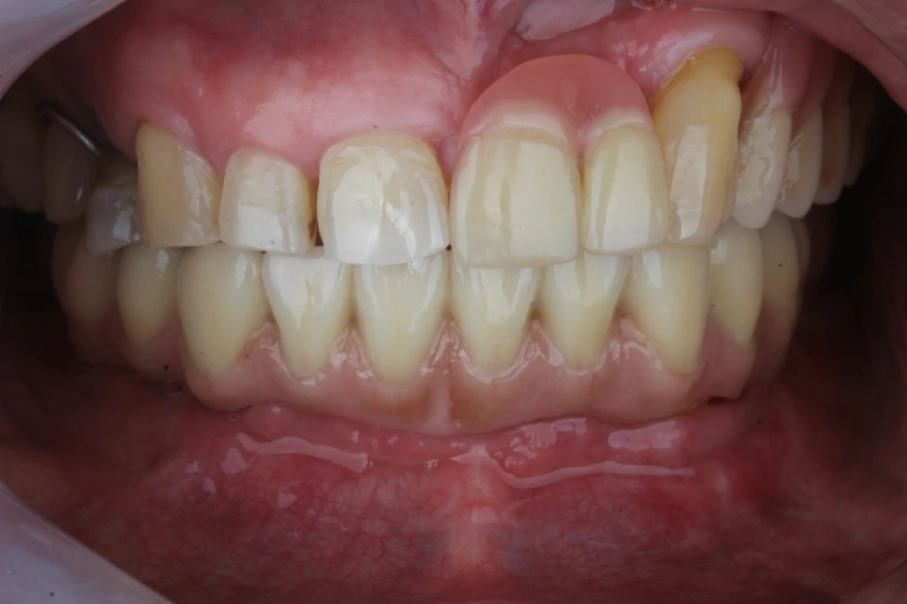 Caso 1 - Odontología Digital