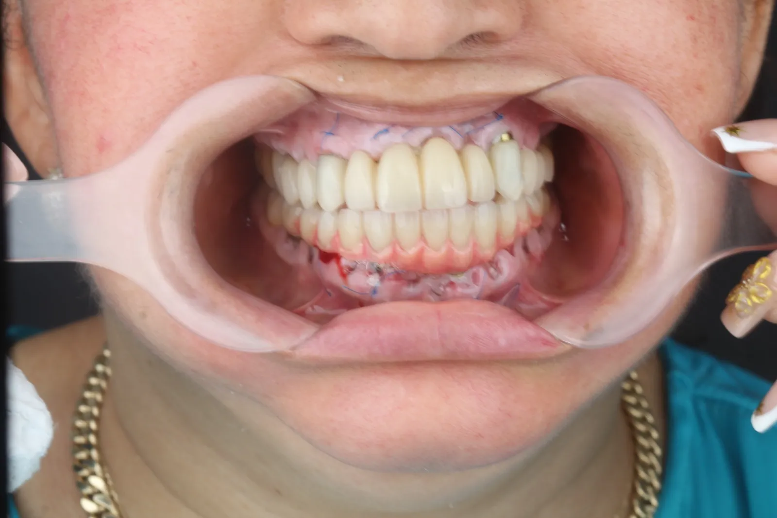 Cirugía digital — imagen 1