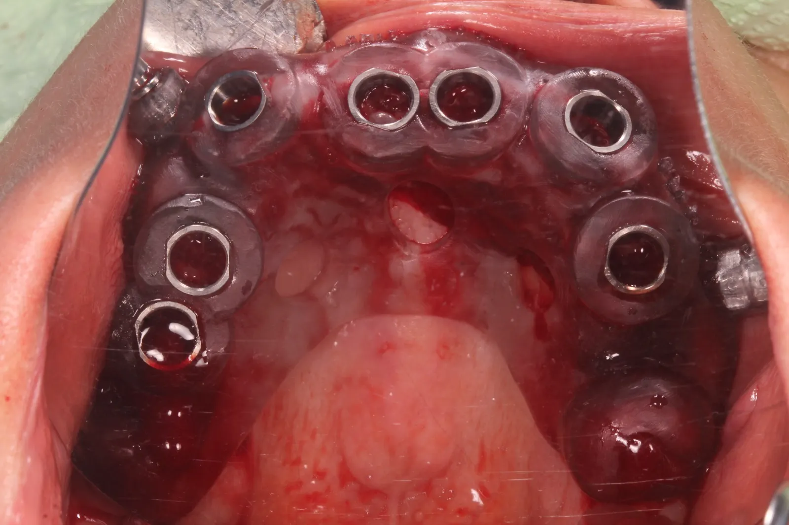 Cirugía digital — imagen 2