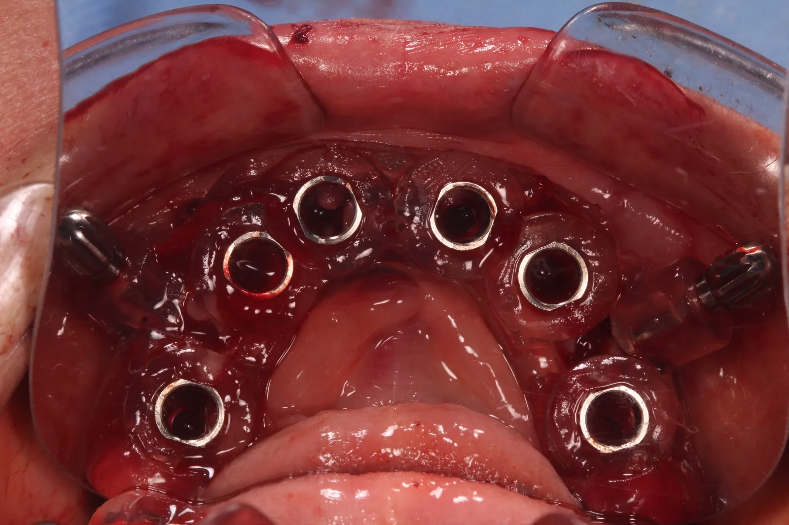 Cirugía digital — imagen 3