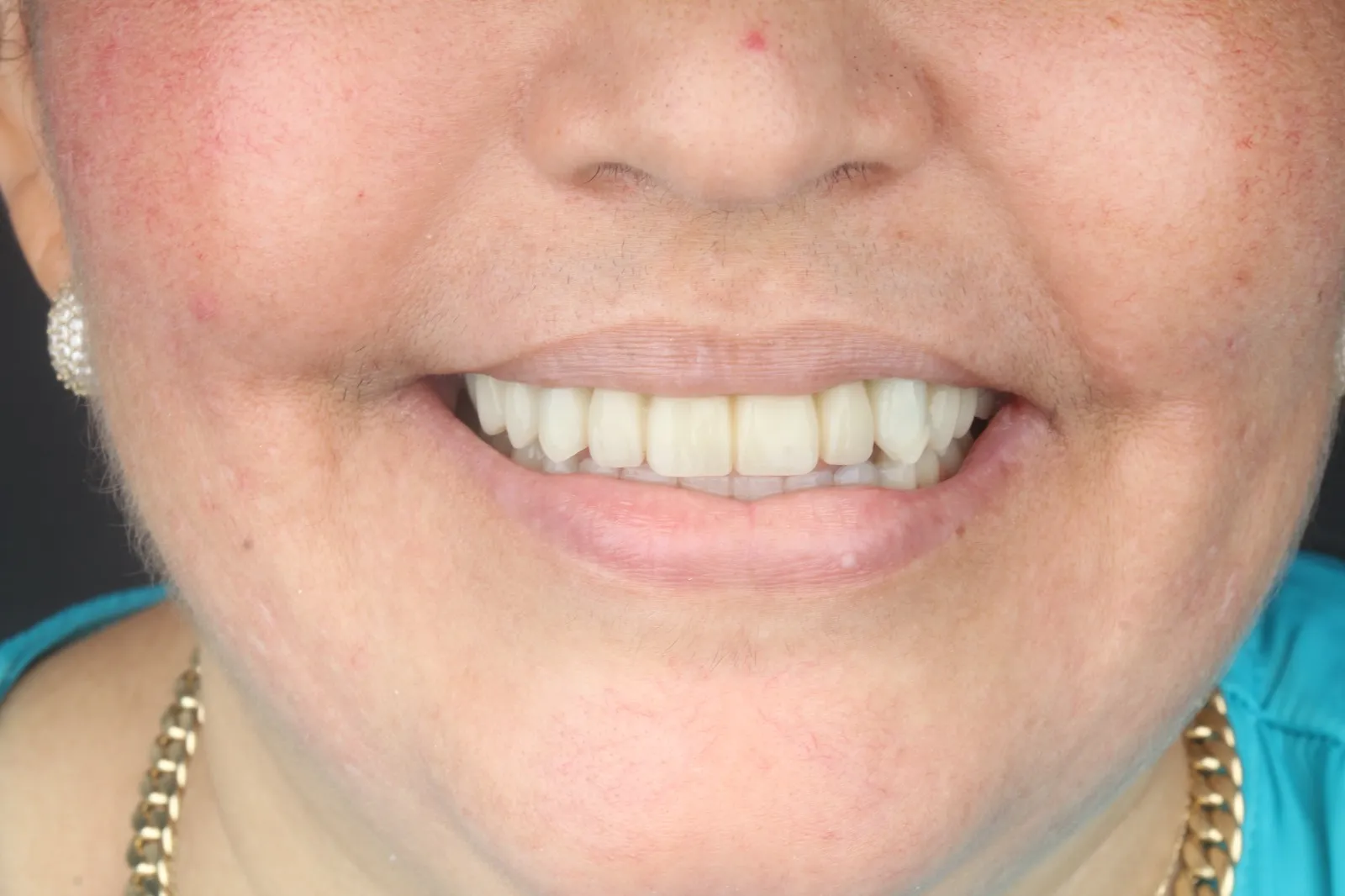 Cirugía digital — imagen 4