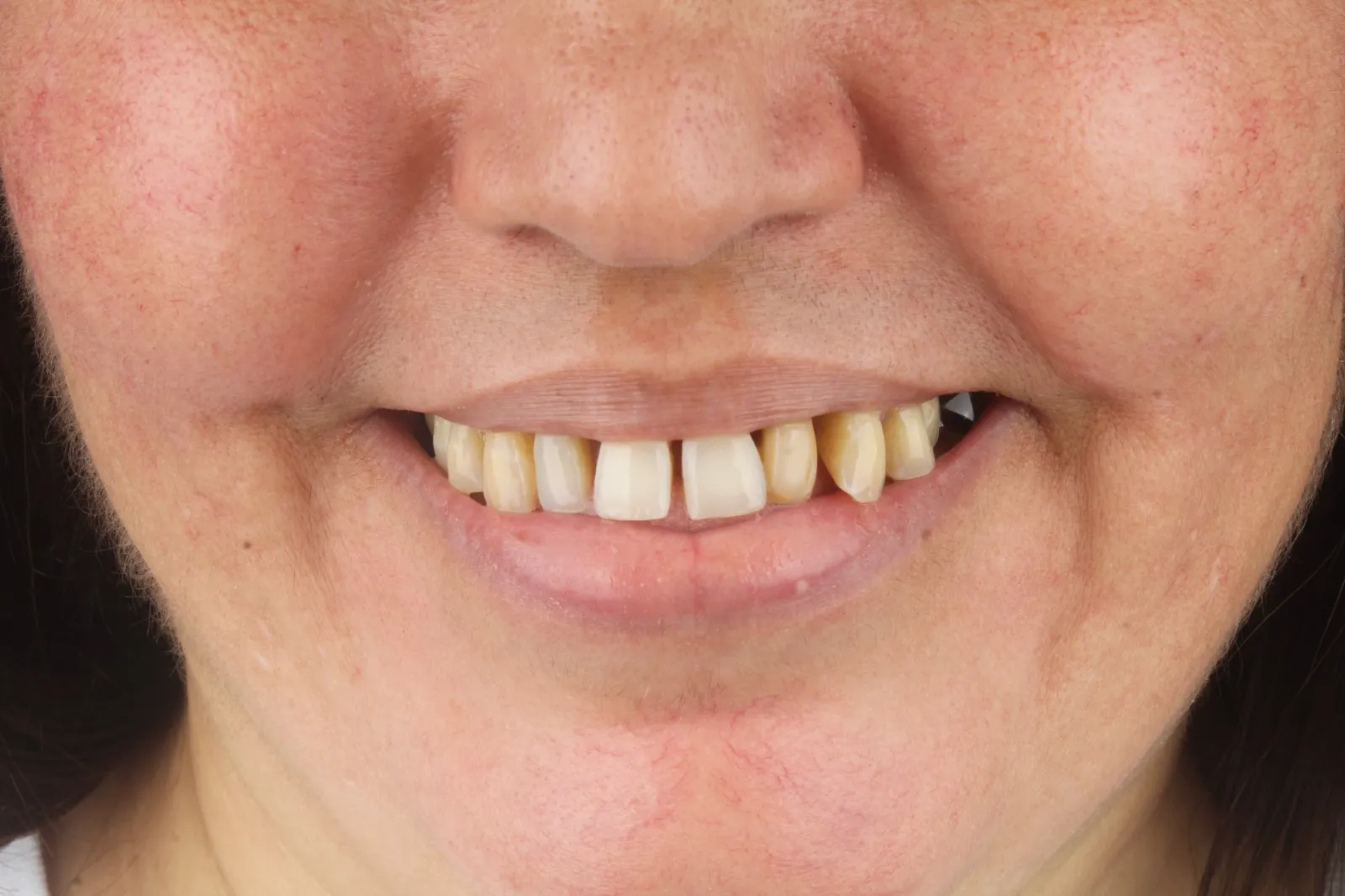 Cirugía digital — imagen 6