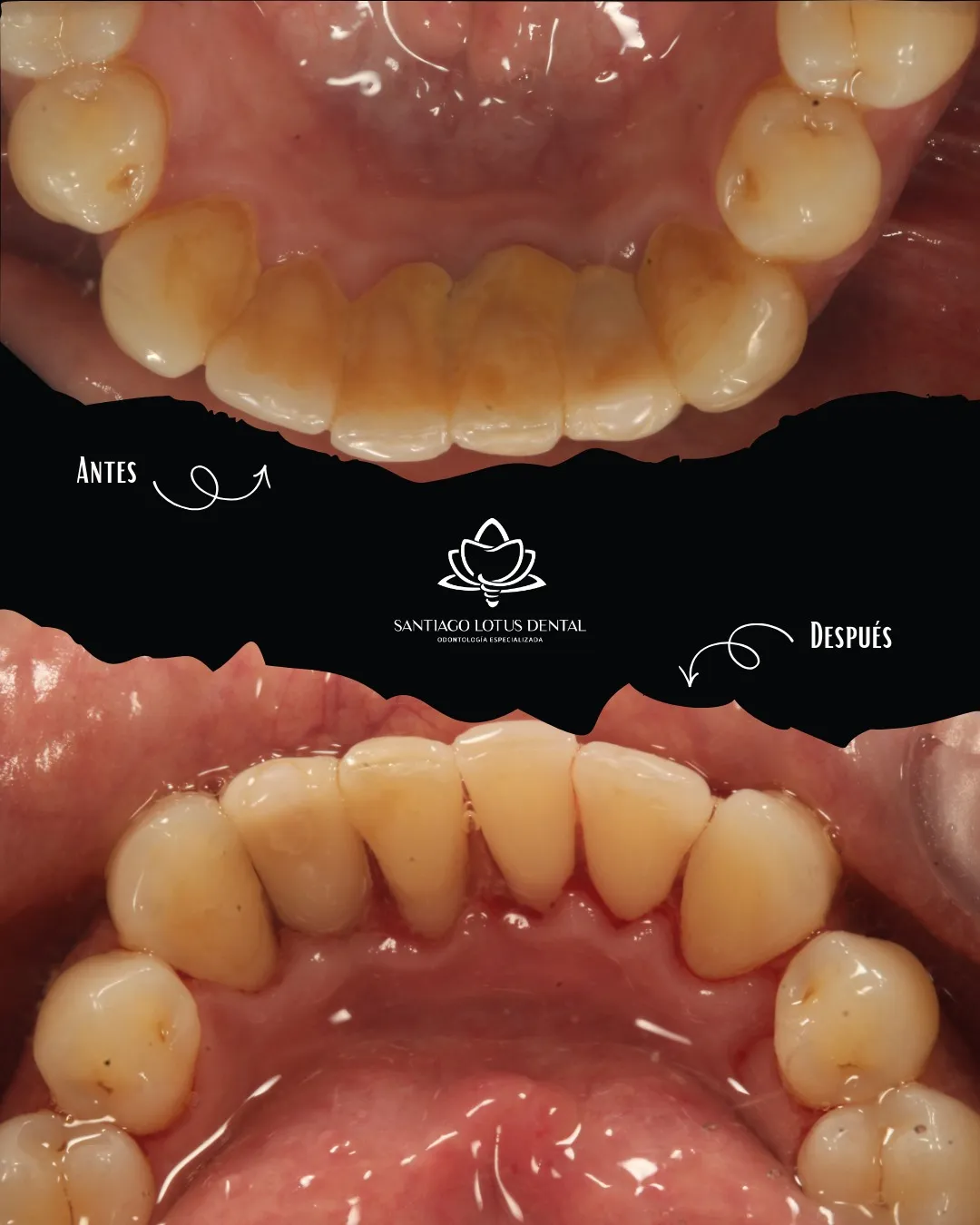 Sandra Ortega - Testimonio Aqua Care