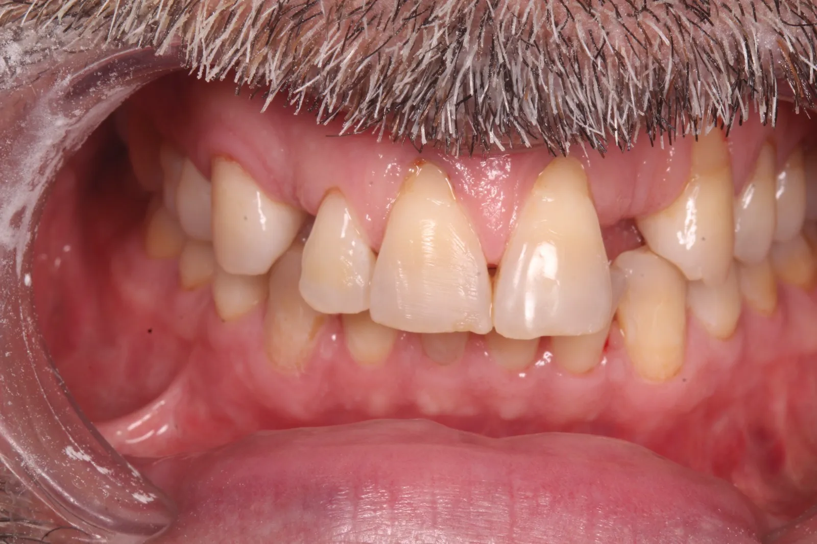 Testimonio Aqua Care