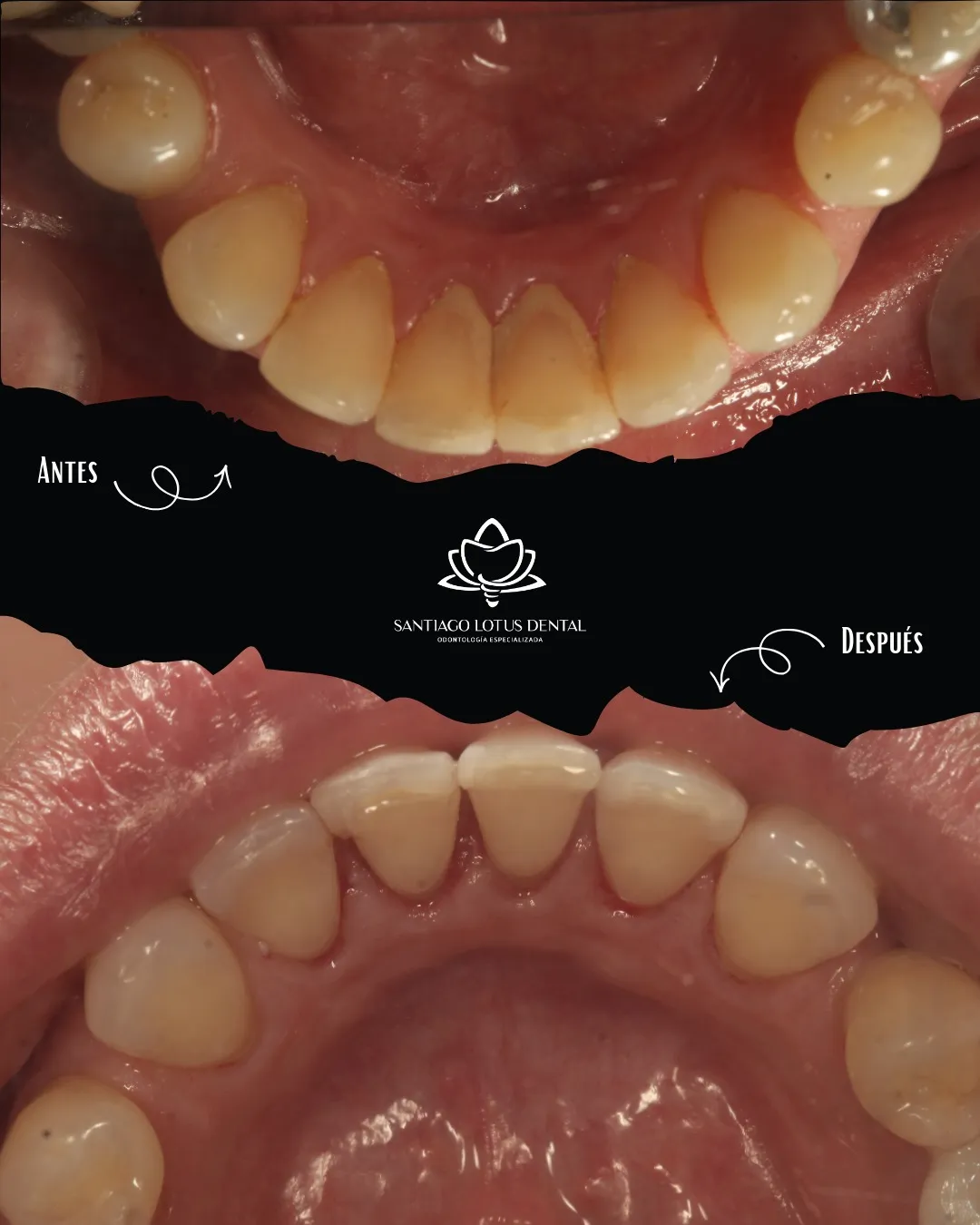 Testimonio Aqua Care