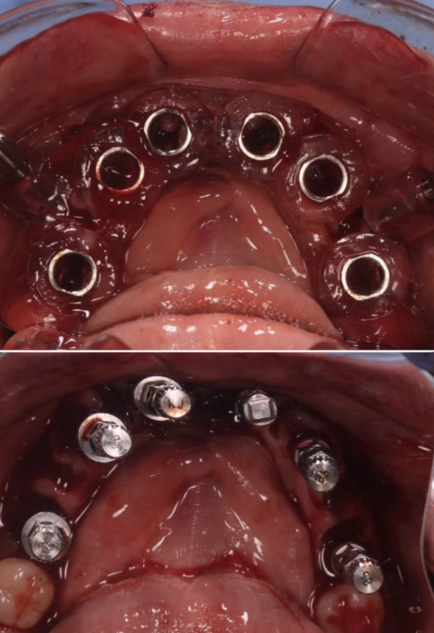 Muestra Odontología Digital