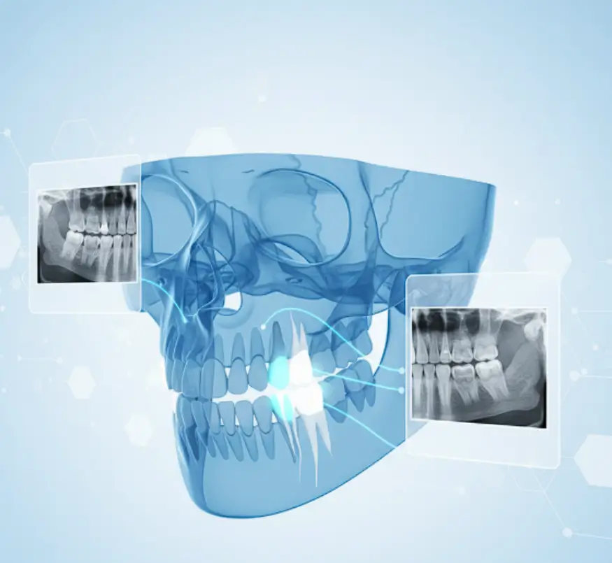Radiografías Dentales Santiago Lotus Dental