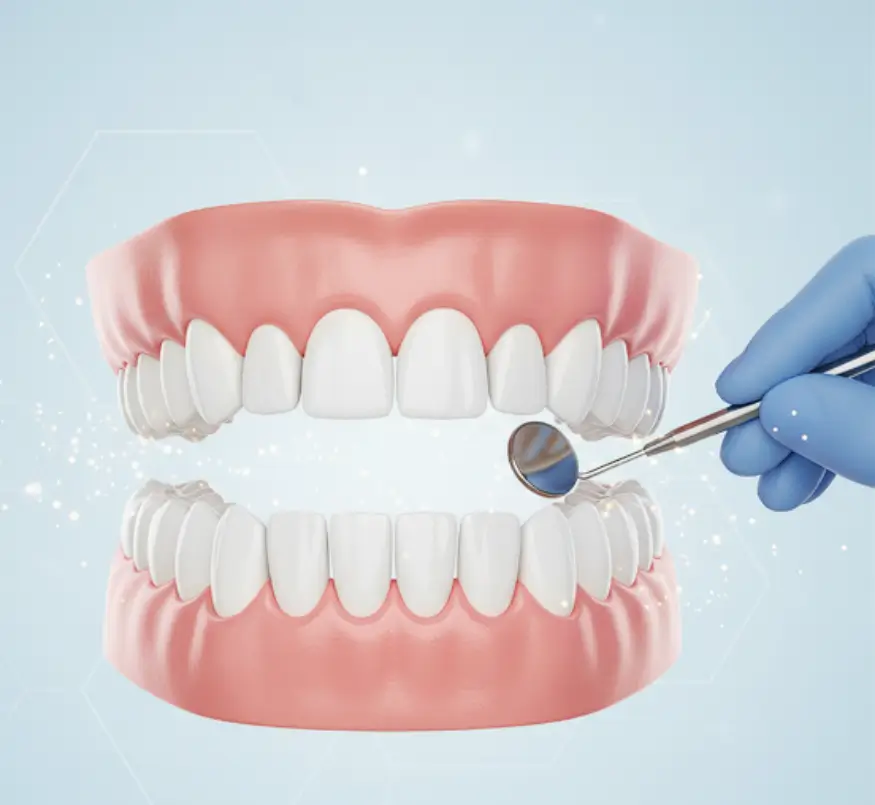 Aesthetic Dentistry Santiago Lotus Dental